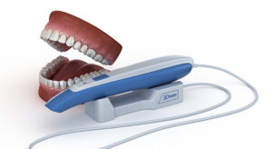 Read more about the article Intraoral Scanning