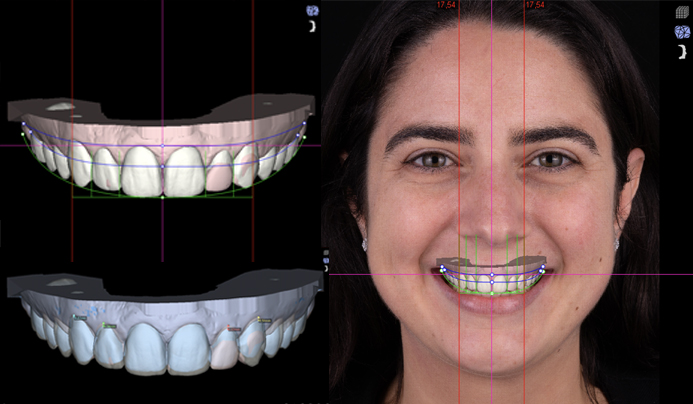 You are currently viewing The Role of Dental Technicians in Smile Design and Esthetics